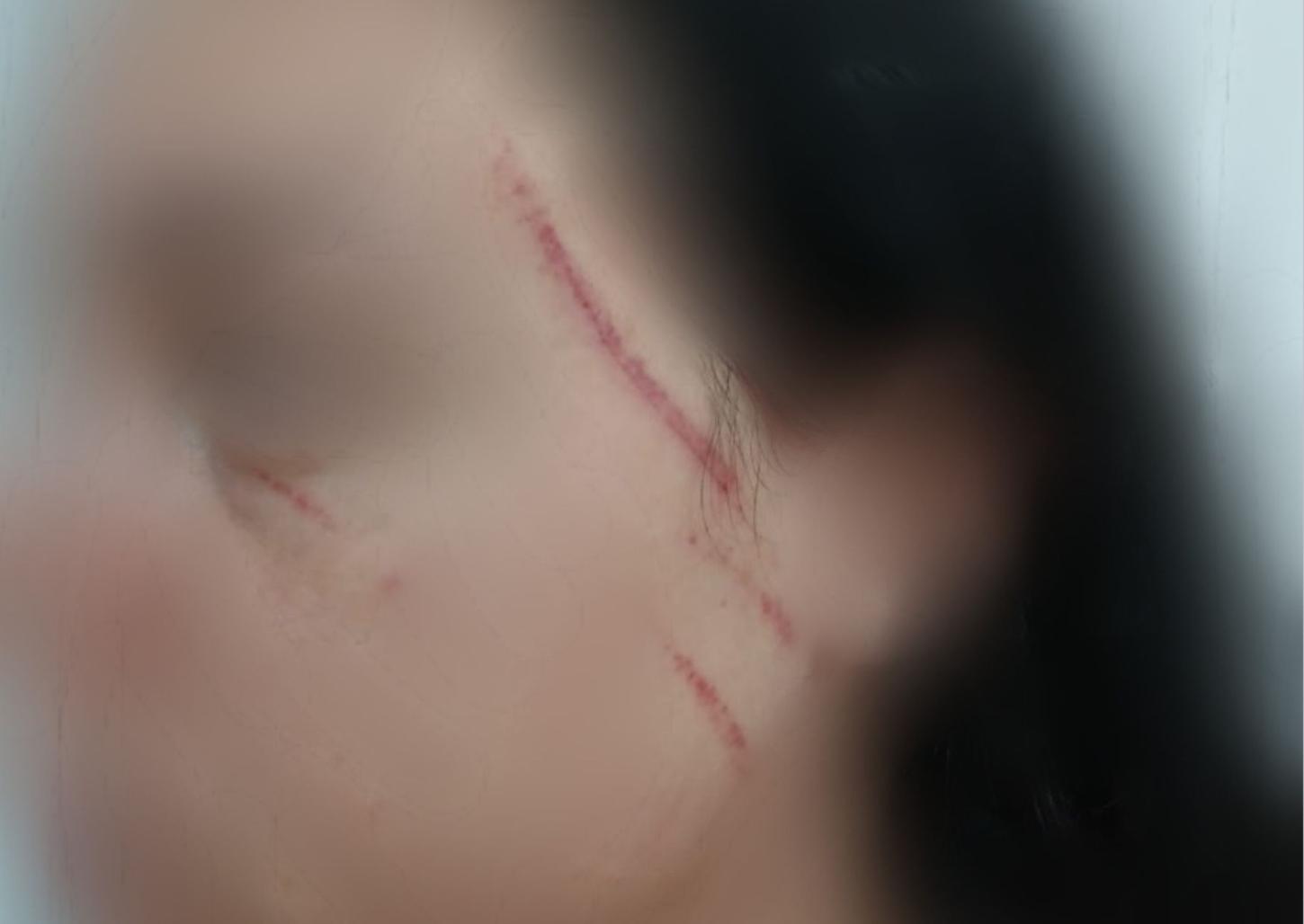 Polícia investiga caso de agressão por divergência política em Cristais Paulista