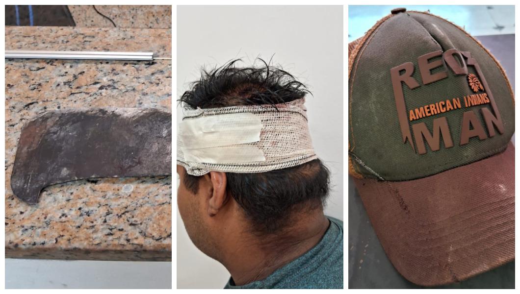 Serviços Gerais tenta matar caseiro com golpe de podão na cabeça e é preso pela PM