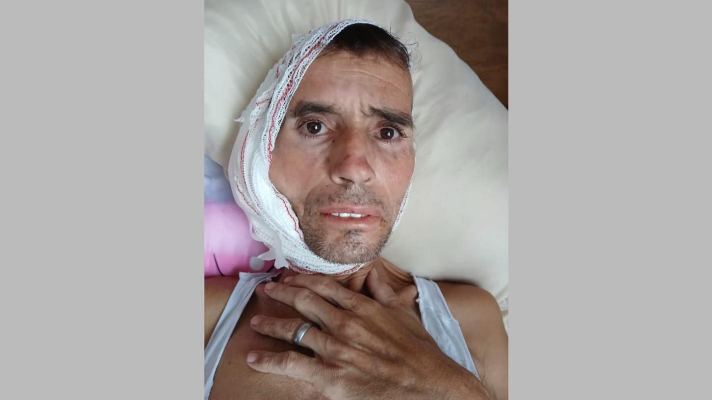 Prima de paciente com câncer reclama de descaso na rede pública de saúde