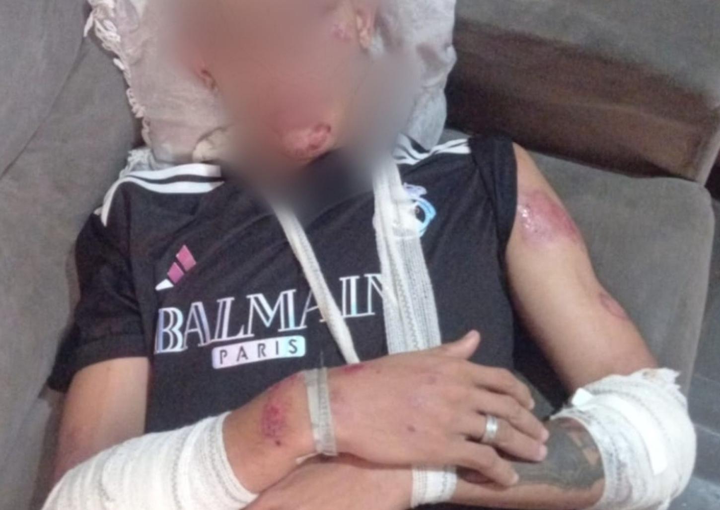 Motorista atropela jovem na virada  do ano e foge sem prestar socorro