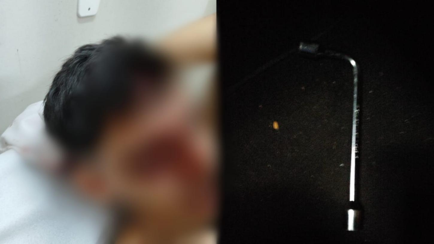 Estudante de 17 anos é agredido com chave de roda na porta de escola