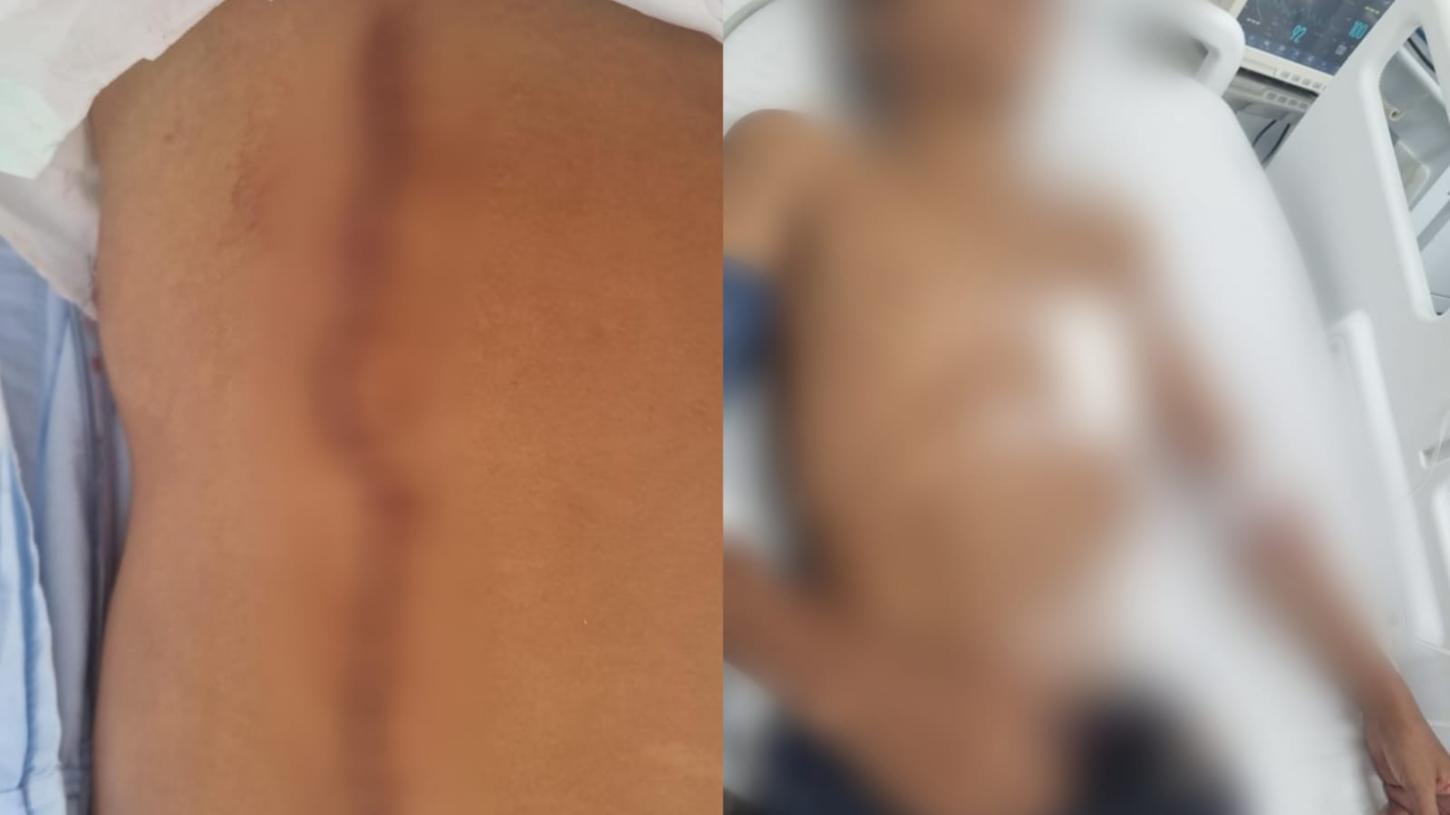 Adolescente esfaqueado na zona rural de Itirapuã segue internado