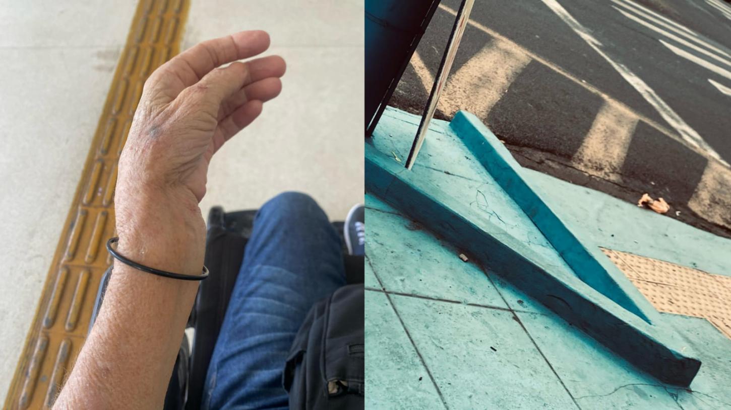 Idosa fratura braço após tropeçar em coluna feita em calçada no Leporace
