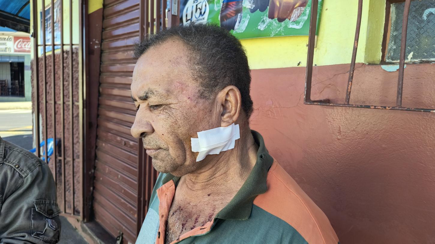 Comerciante de 70 anos é baleado durante tentativa de assalto na Chico Júlio