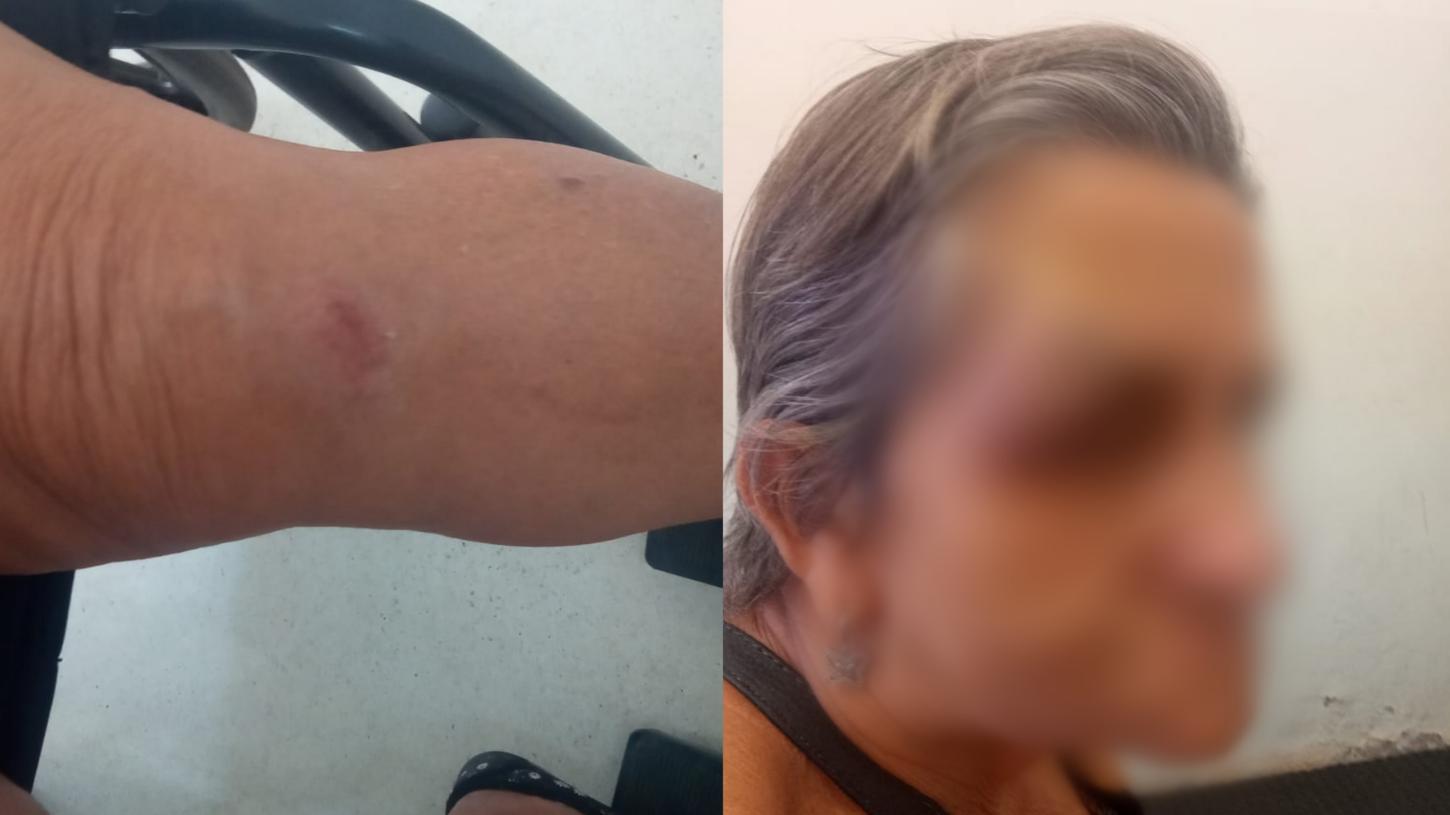 Família registra BO após Idosa sofrer queda dentro de ônibus da São José