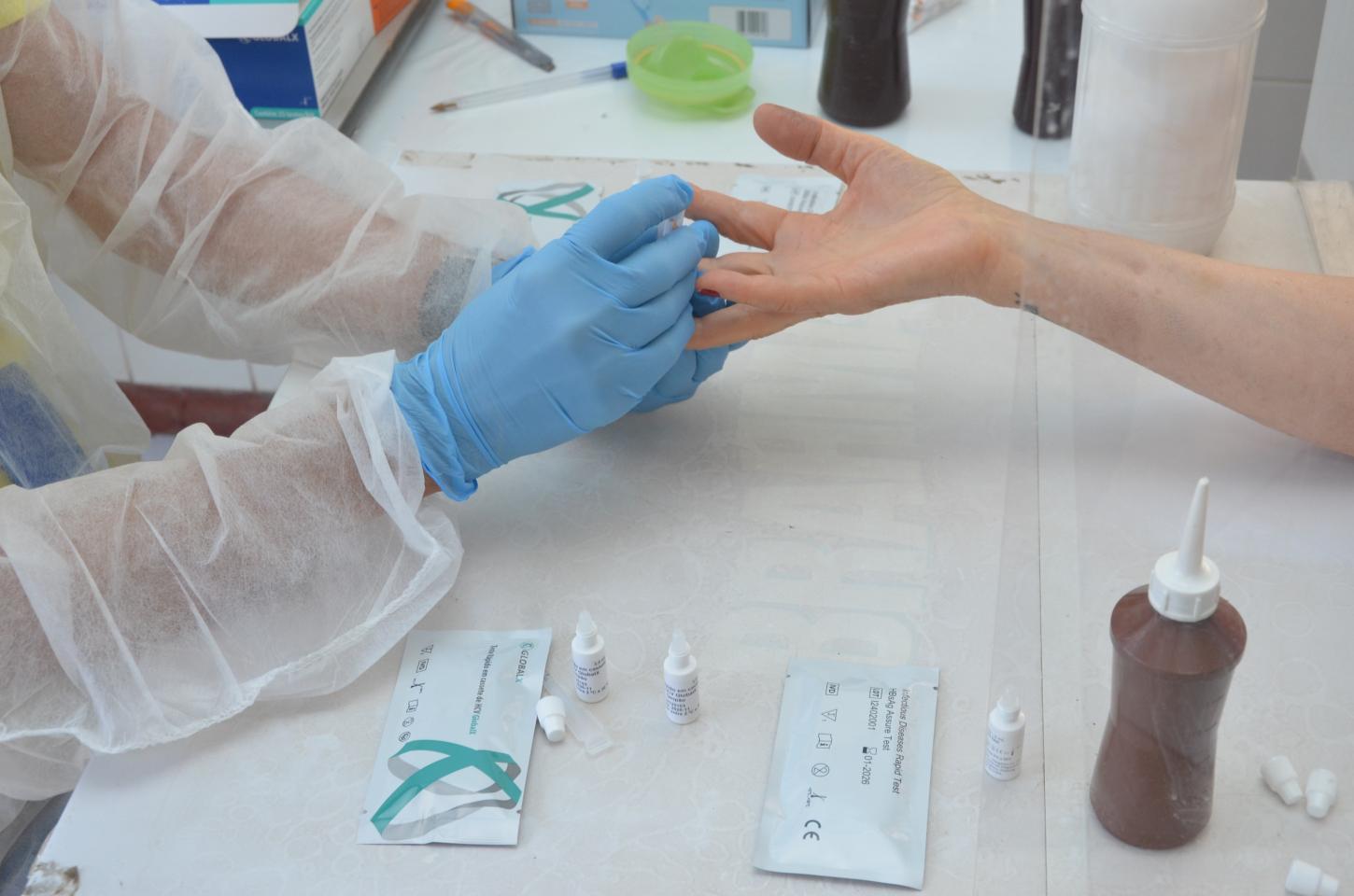Campanha “Fique Sabendo” oferece testes gratuitos de HIV e sífilis