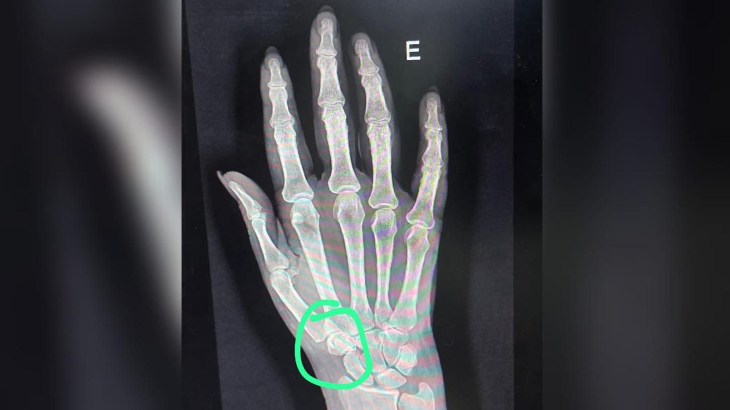 Técnica de enfermagem do Samu é agredida durante ocorrência